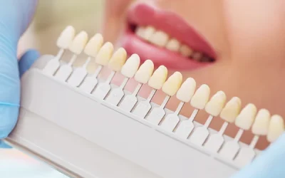 Exploring the Lifespan of Tooth Fillings for Better Dental Health