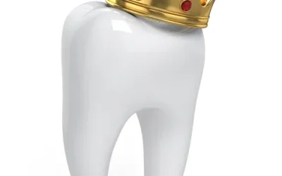 Dental Crown Placement Process: Step by Step Guide