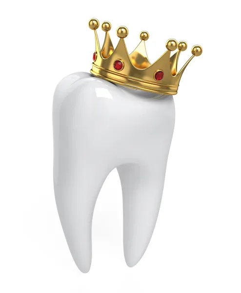 Dental Crown Placement Process: Step by Step Guide