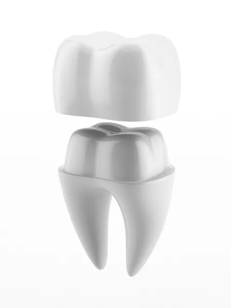 Dental Crown for Broken Tooth: Restoring Strength and Beauty